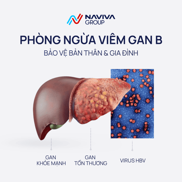 Phòng ngừa viêm Gan B